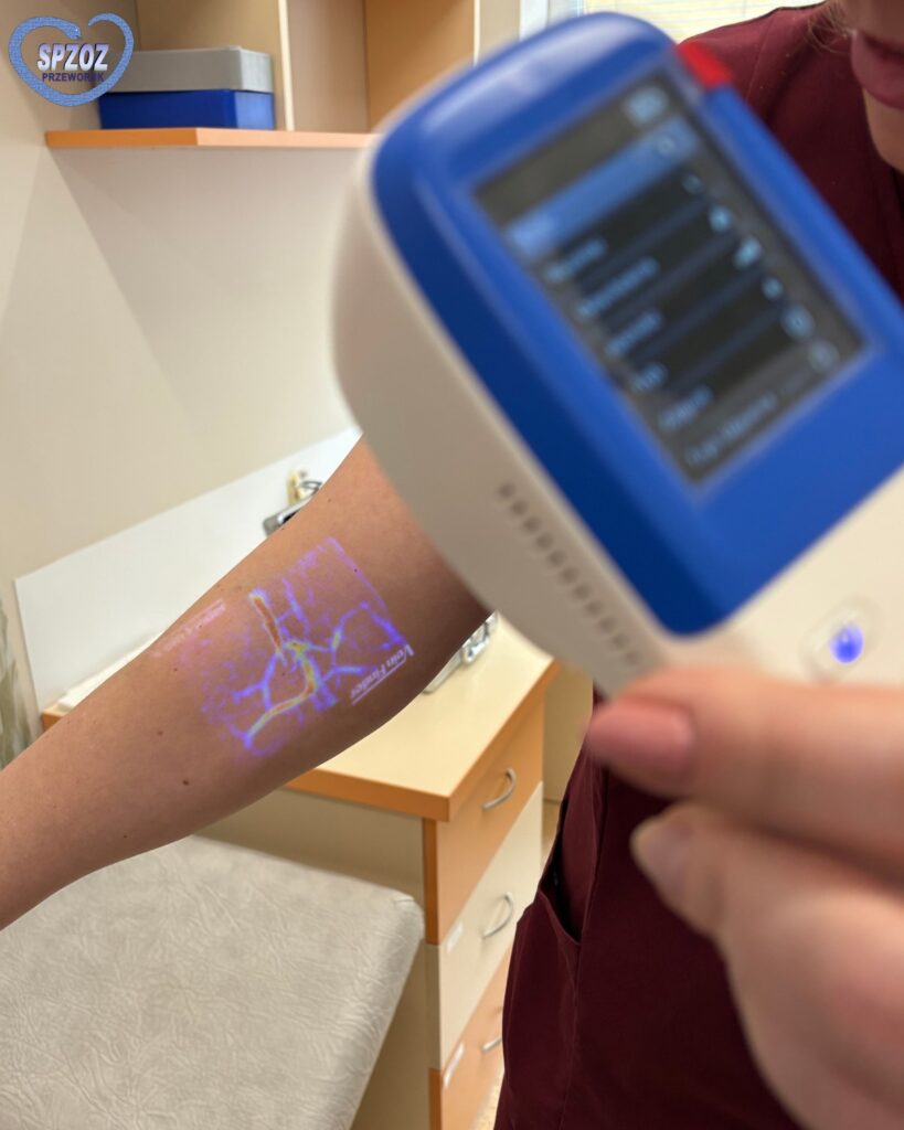 Punkt Pobrań W Przeworsku Po Modernizacji. Szpital Kupił Specjalistyczny Skaner Do Żył